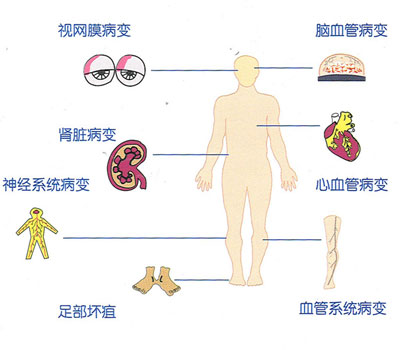 信息图片