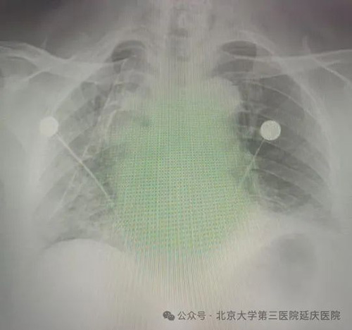 图片31.jpg
